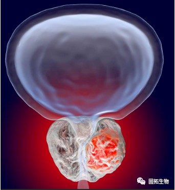 前列腺癌新藥！基肽酶抑制劑talabostat聯(lián)合Keytruda在腺癌表型晚期難治性mCRPC療效令人鼓舞!